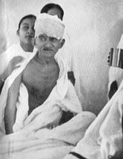 Gandhi just after ending his fast at Rajkot. March 7, 1939.